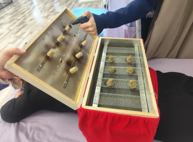 隔物灸腰：传统中医治疗腰痛的有效方法