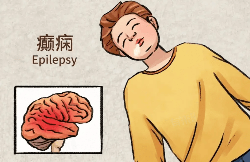 怎样才能预防癫痫