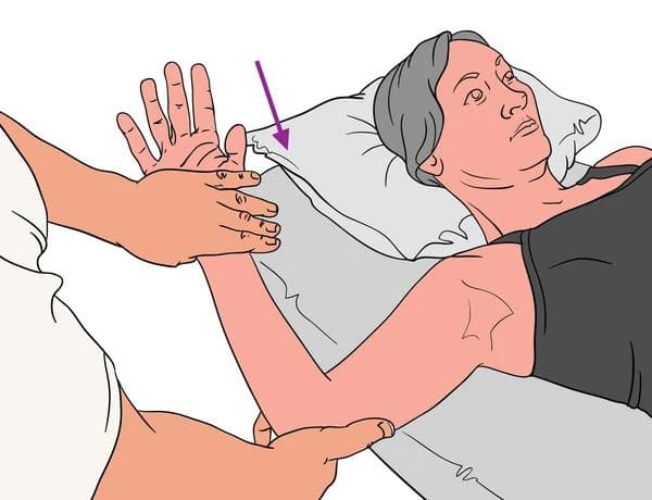 肩部疼痛怎么办？肩胛下肌触发点处理方法详解