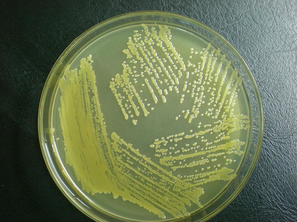 微生物实验常用的10种培养基的配制说明