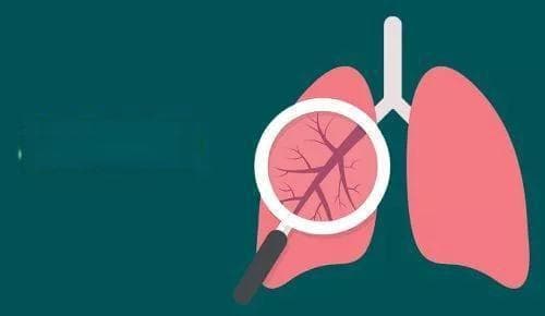 慢阻肺的综合管理，一定重视起来