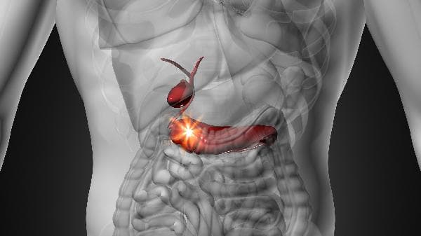 胰腺癌症晚期患者临终前15个症状