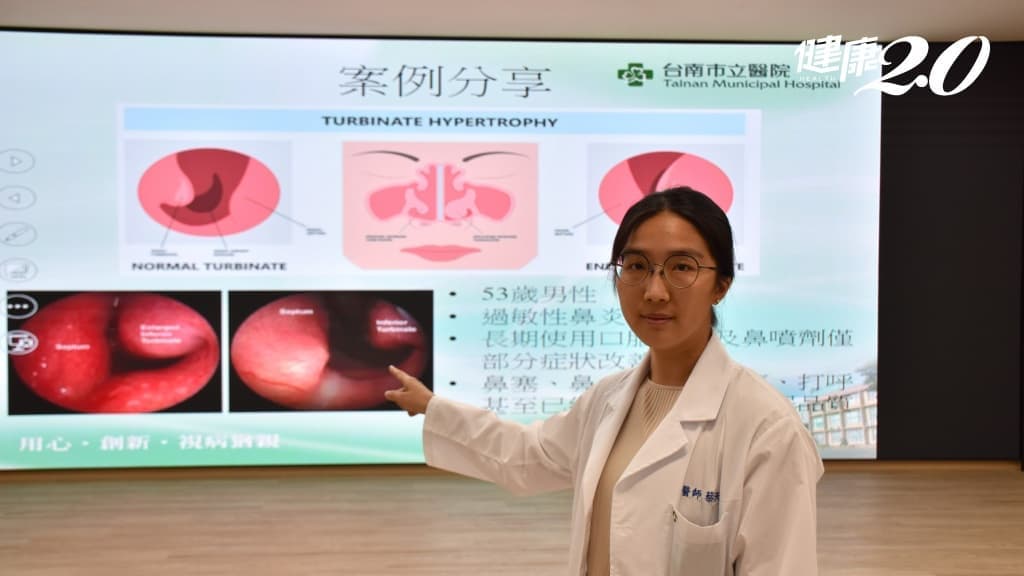 鼻塞无法睡原来是过敏性鼻炎！鼻甲肥厚鼻中膈弯曲 手术+药物终于睡好觉
