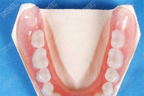 吸附性义齿制作全过程：比普通假牙好在哪？价格贵不贵