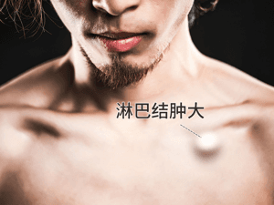 脖子左侧后面有个硬包是什么原因