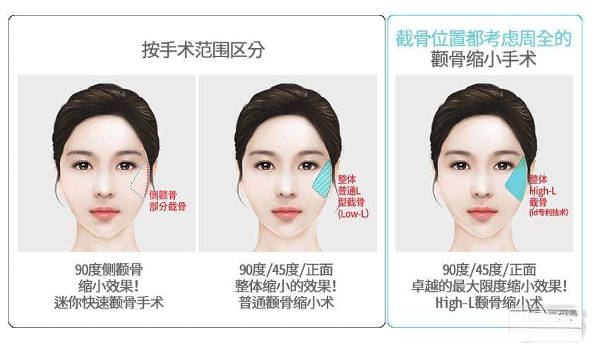 揭秘高颧骨之美：五官量感、立体度与面部衔接的和谐之道
