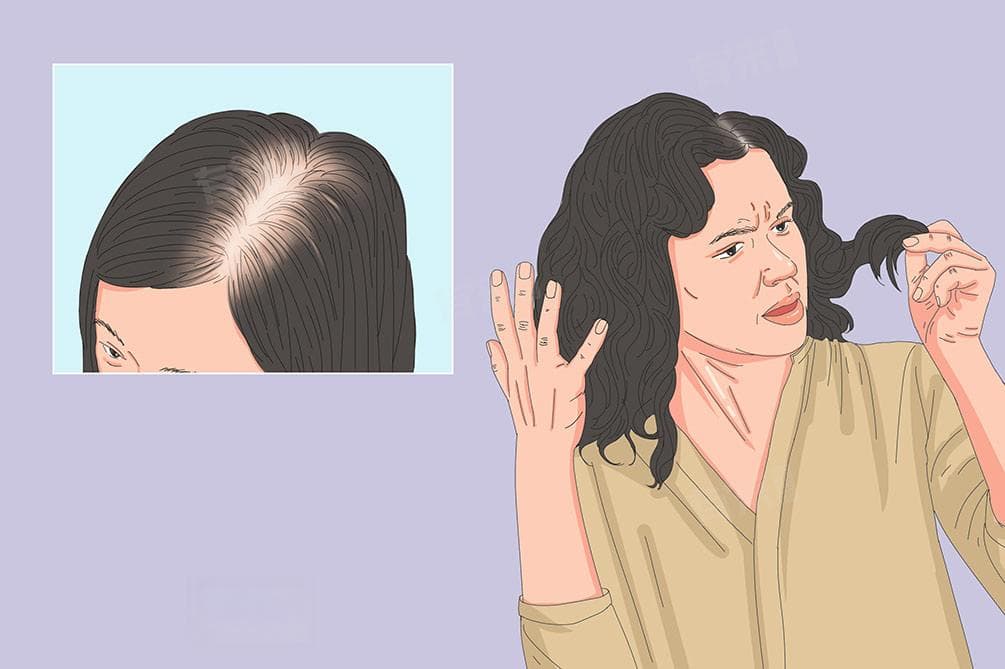 女性脱发原因及应对方法