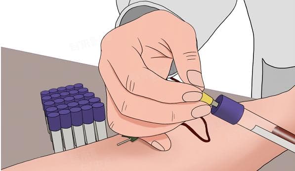 传染病四项检测全解析：HIV、HBV、HCV和梅毒螺旋体抗体