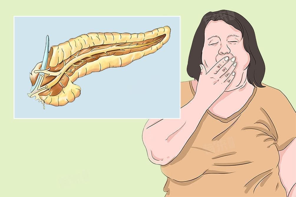 糖尿病人最佳零食及治疗方案