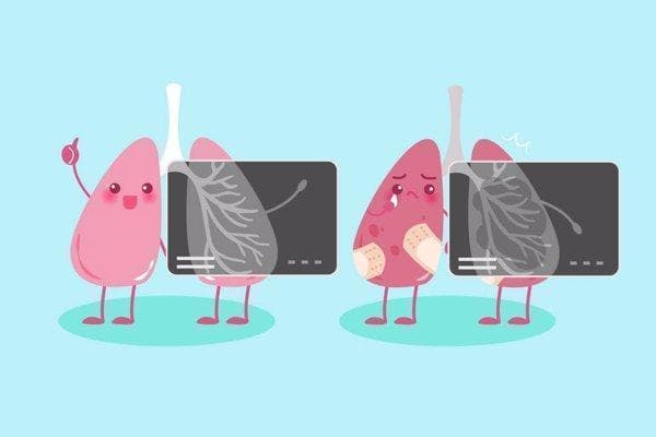 白肺的治疗方法