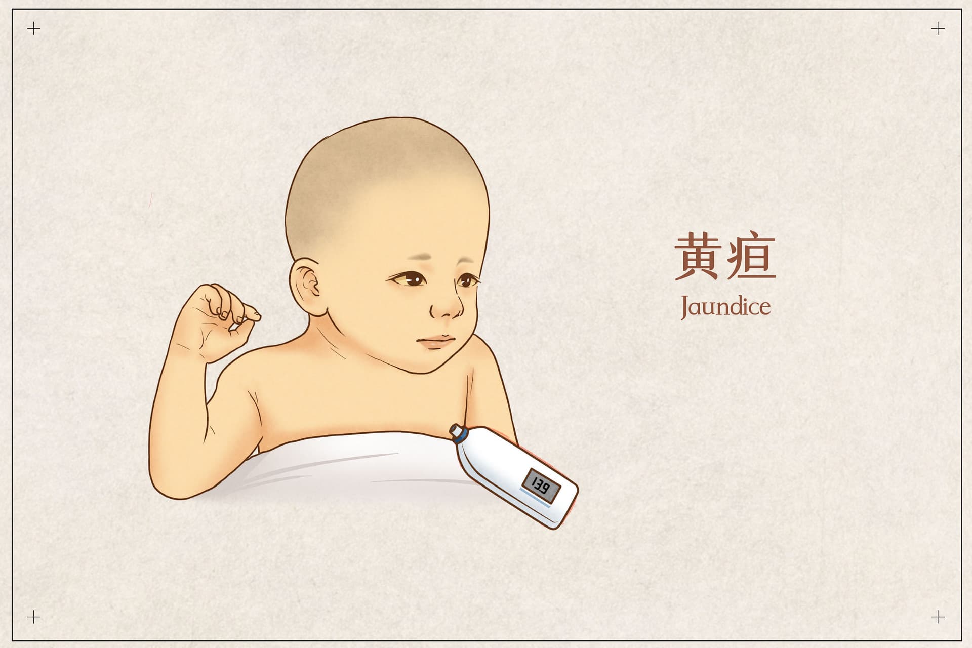 带你正确认识新生儿黄疸