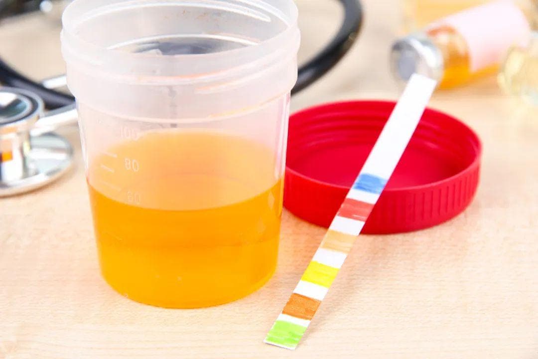 为何身边这么多人都尿酸高？千万别忽视食物中的这种成分