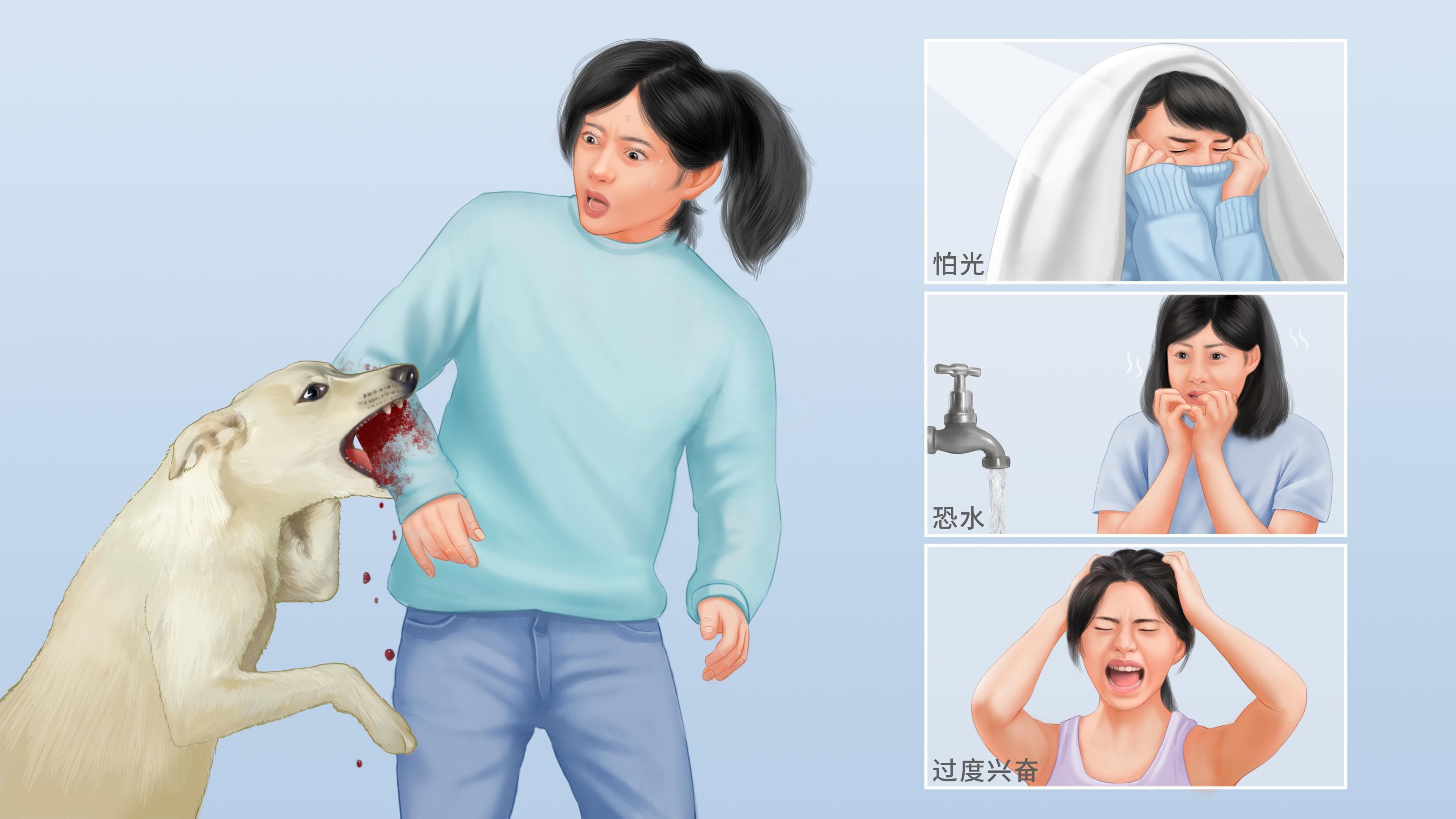 狂犬病：症状、诊断与预防全攻略