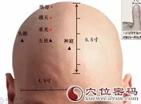治疗头晕、鼻塞、鼻出血的穴位——通天穴