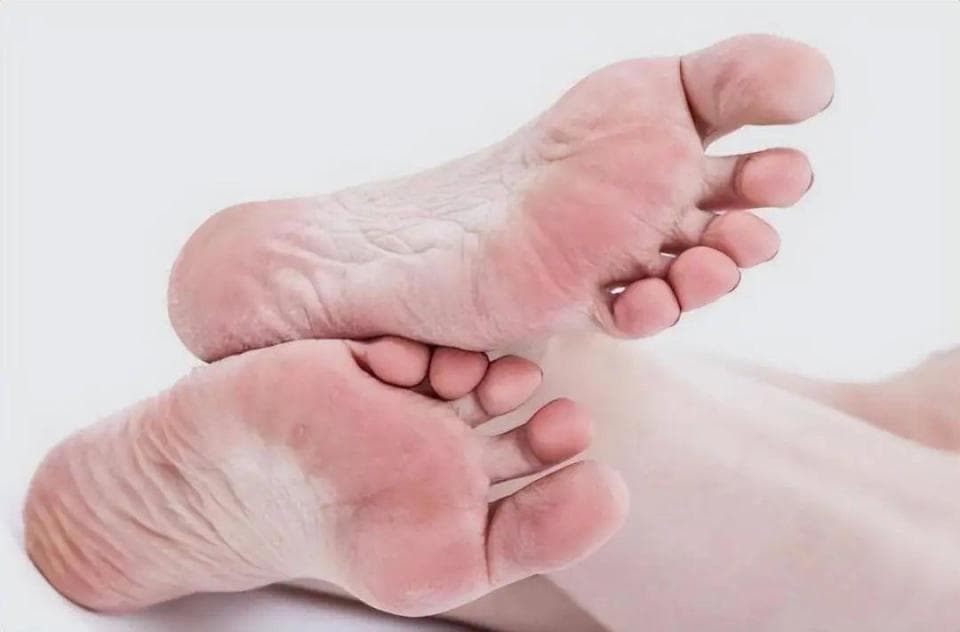糖尿病足的日常防护