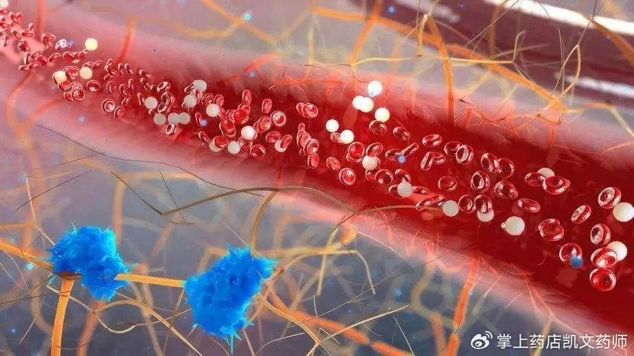 这两个易遭忽略的血液指标含骨转移迹象