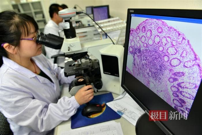 病理报告出检时间缩短至24小时，协和医院“病理诊断绿色通道”惠及11万患者