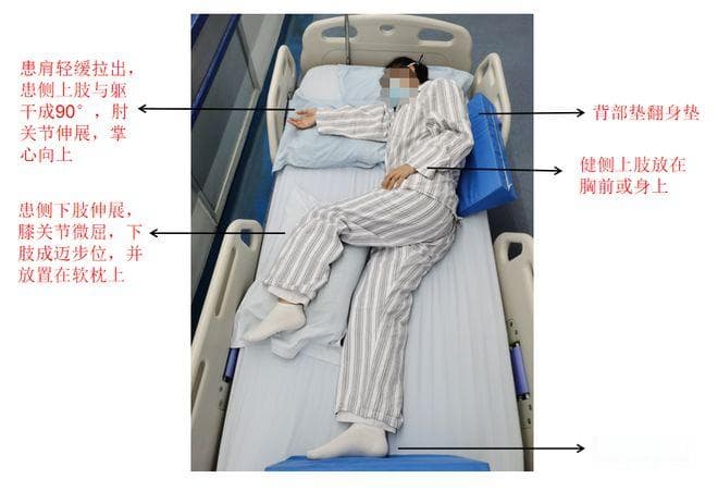 脑卒中患者康复——肢体摆放多图详解