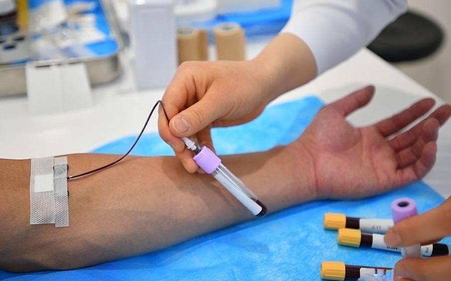 血尿酸540μmol/L以下可先不用药，高尿酸治疗标准来了
