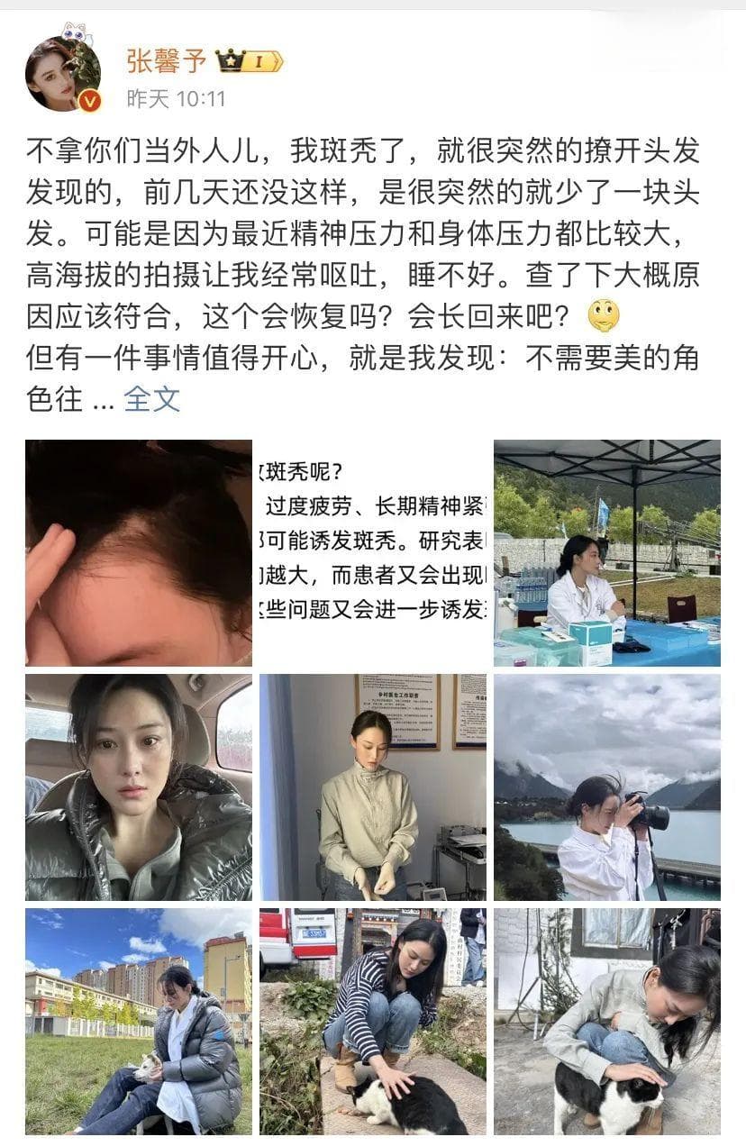 急！头发突然秃了一块！好尴尬，怎么办？