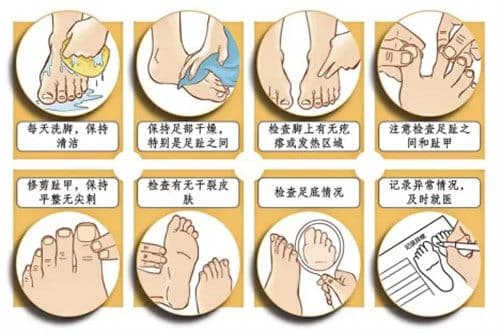 糖尿病足，伤不起的狠“脚”色！