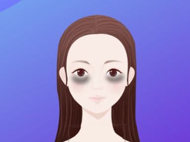 黑眼圈是什么原因导致的