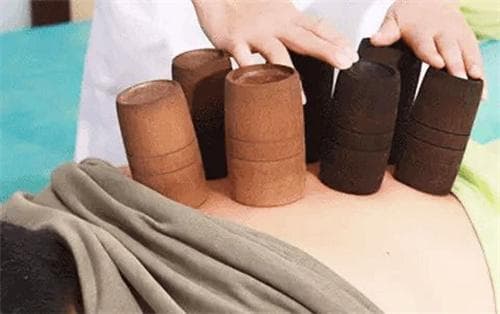 拔罐疗法 中国拔罐的起源与发展