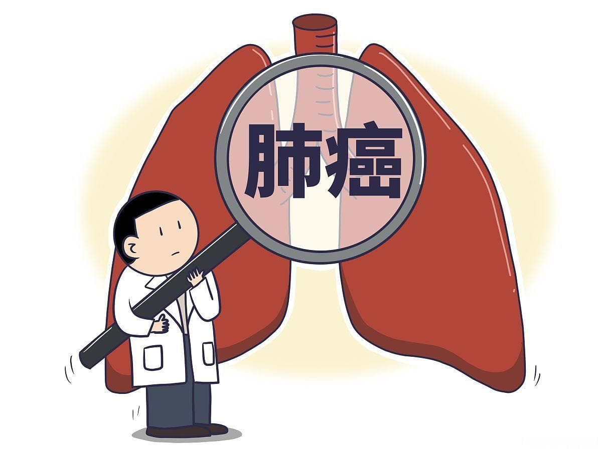 肺癌的早发现与早诊断：选择合适的检查方法