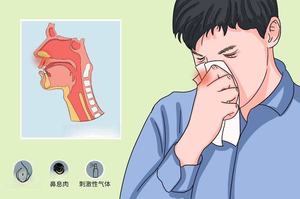 鼻涕是怎么产生出来的