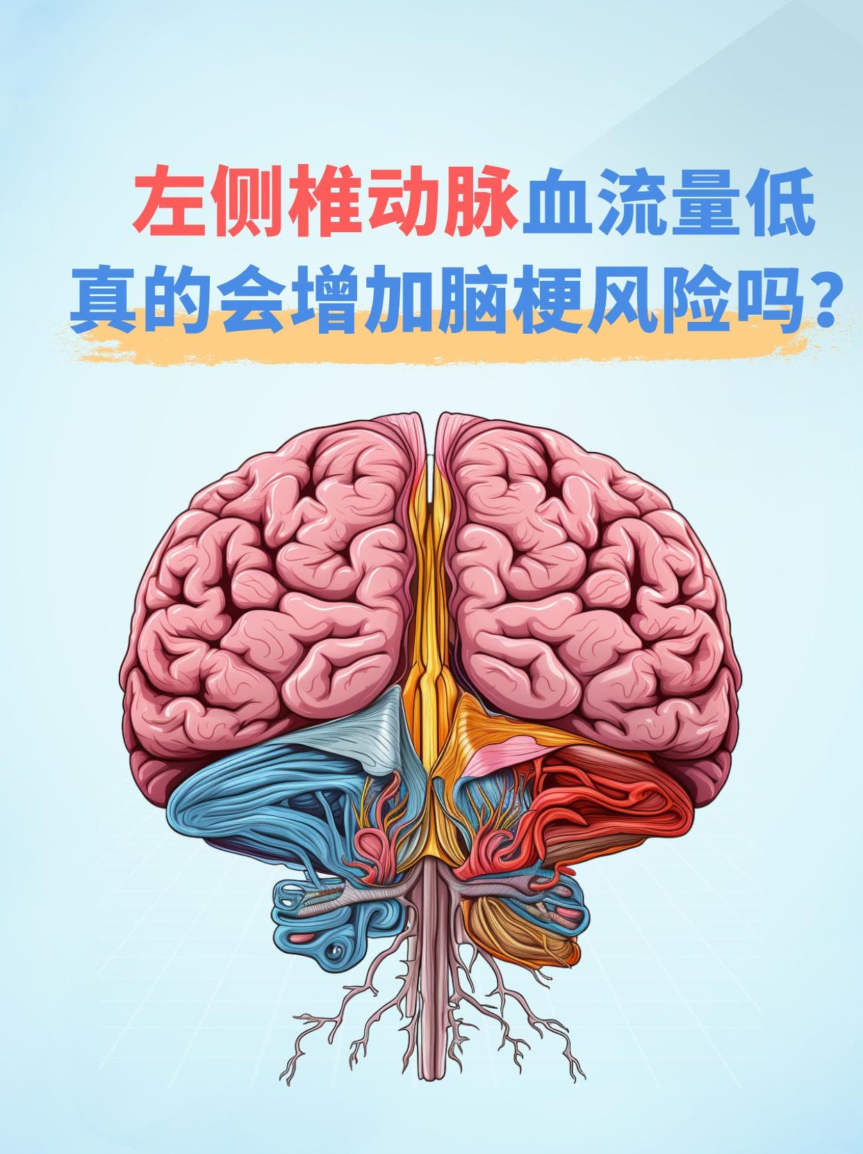 左侧椎动脉血流量低，真的会增加脑梗风险吗？