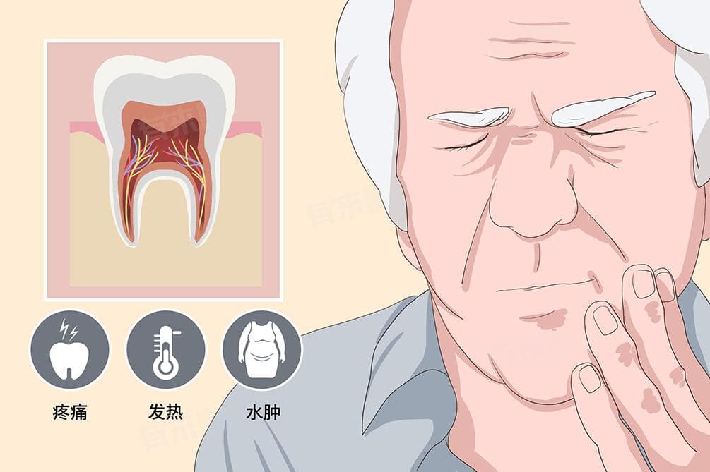 急性牙髓炎怎么快速止痛