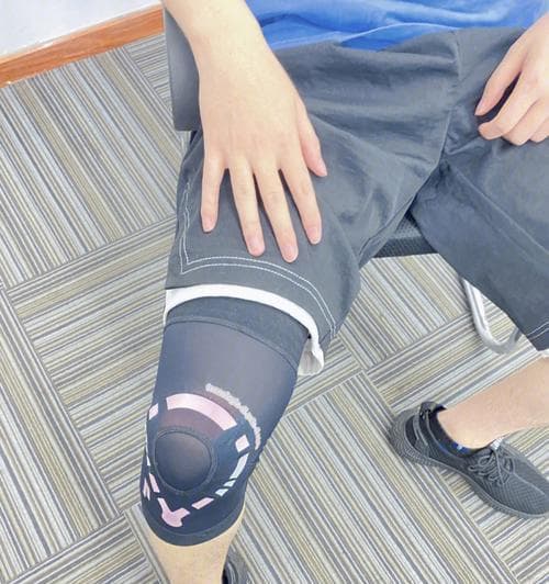 跑步膝盖痛如何快速康复？7天亲测技巧有效吗？