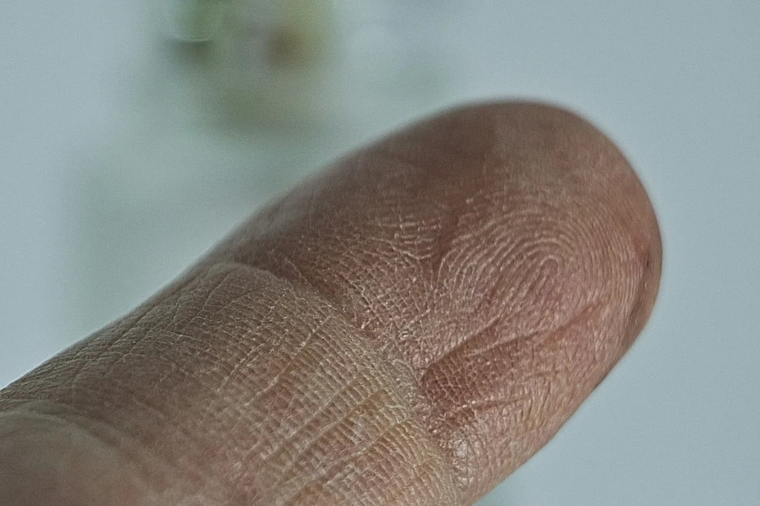 冬季养生：中医教你读懂指甲里的健康密码