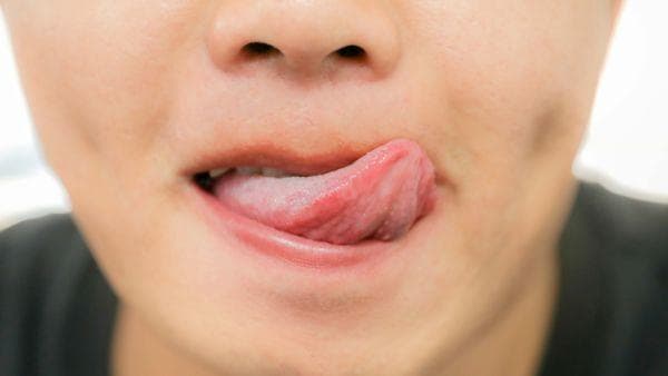 舌头发麻怎么办