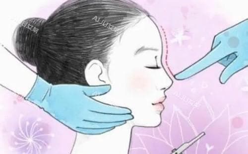 整容好还是不整容好：一场关于自我认知与美的深度探讨