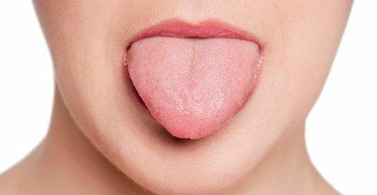 舌头抽筋、疼痛怎么办？原因、症状与治疗方法全解析