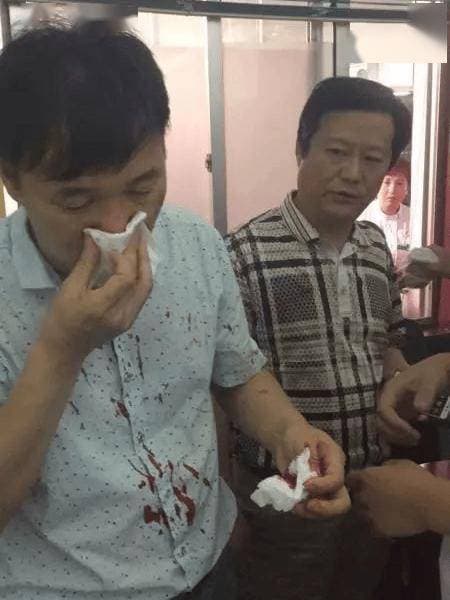 山东一地300人围攻医院，副院长被暴力袭击！