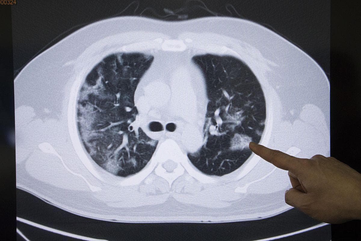 做增强CT，医生提醒五句话，别忽视