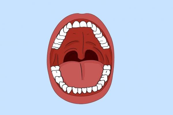 口腔癌早期症状有哪些 有口腔病史者如何预防口腔癌