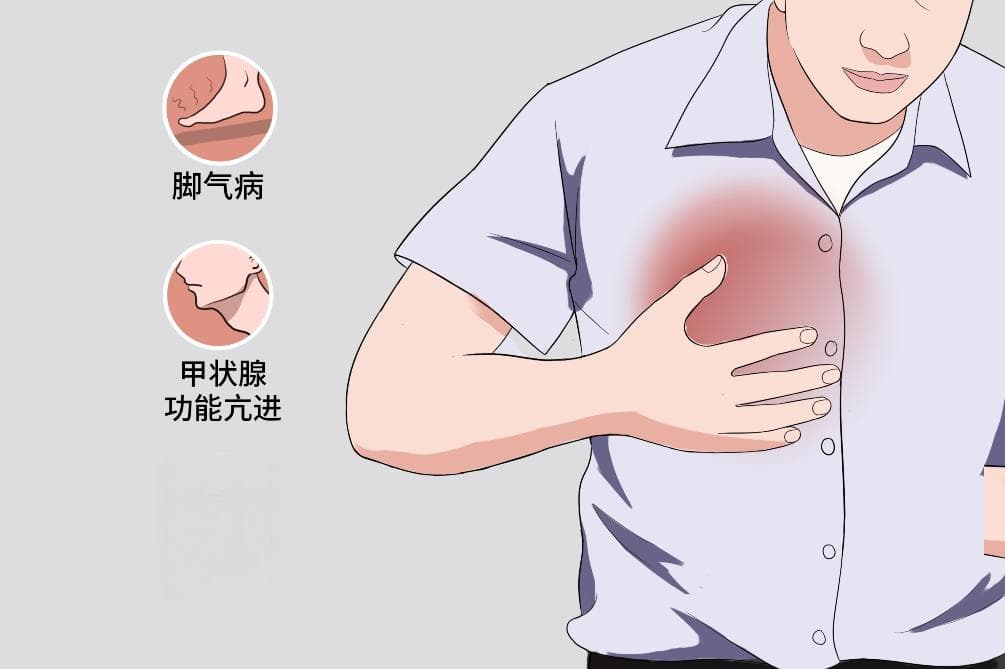 水冲脉：定义、病因、诊断与治疗全解析