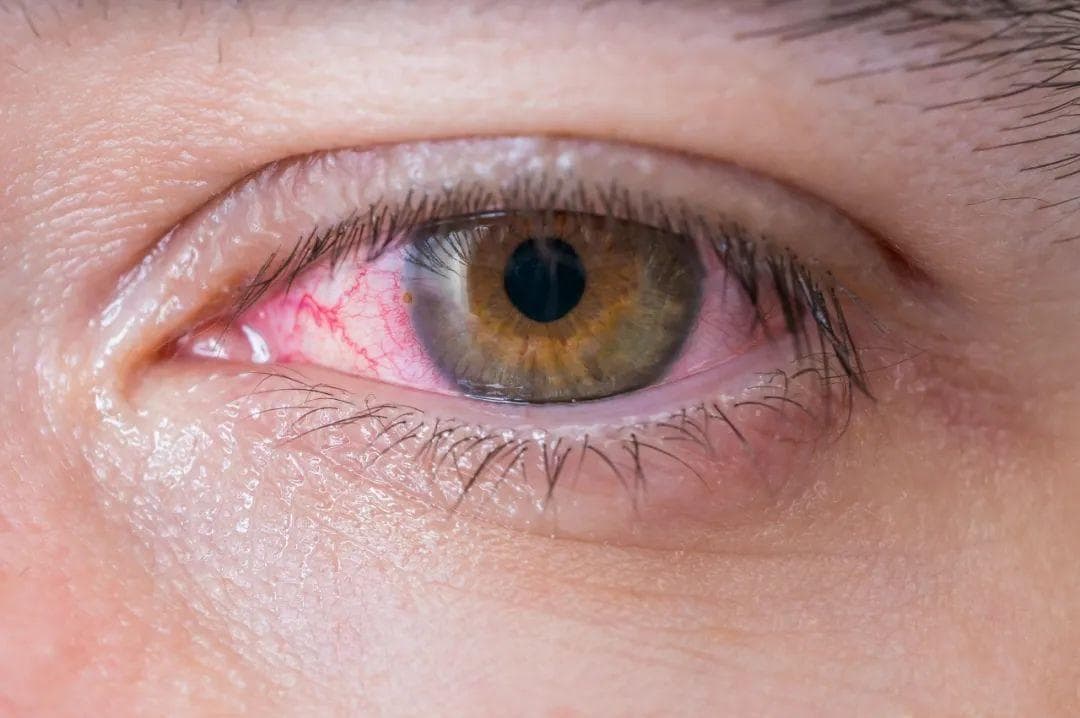 5个部位暗藏脾胃健康密码，8种食材助你调理脾胃