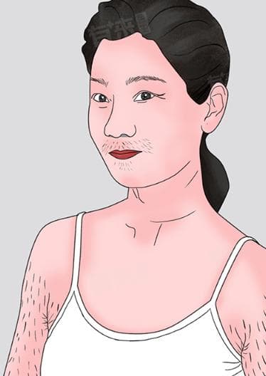 体毛旺盛的女孩子说明什么