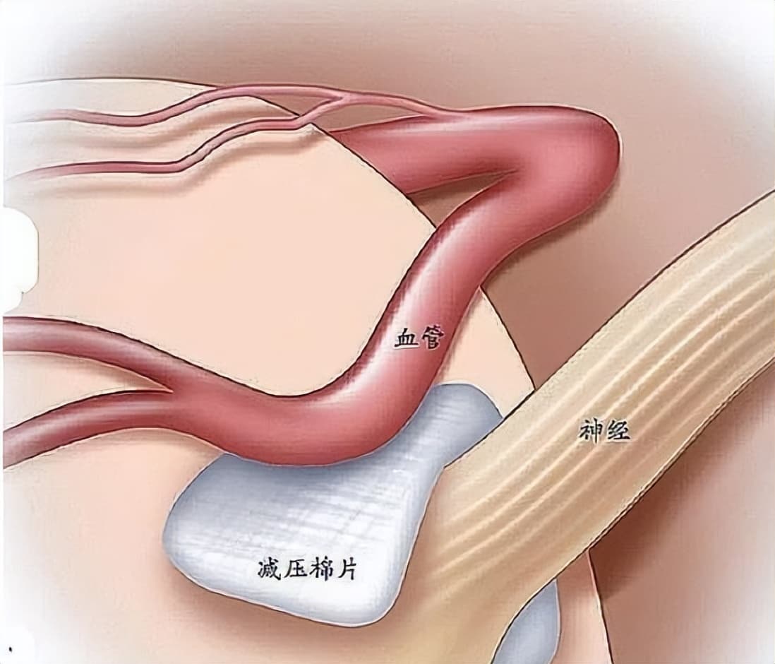 为什么左眼睛一直在跳（左眼跳财，右眼跳灾？）