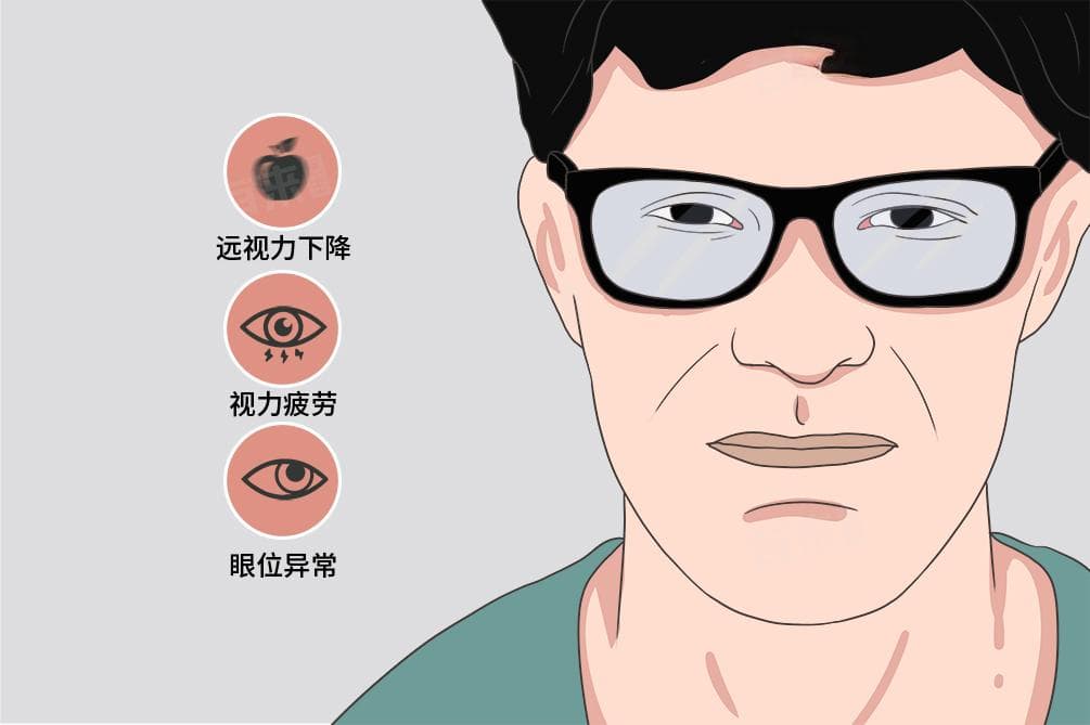 真性近视与假性近视的区别