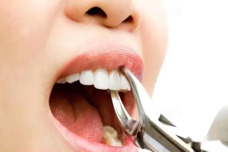 拔牙挂口腔什么科室？一文详解口腔颌面外科与综合口腔科区别