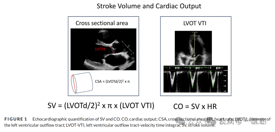 多普勒超声心动图在心源性休克中的应用：LVOT-VTI的作用与局限性