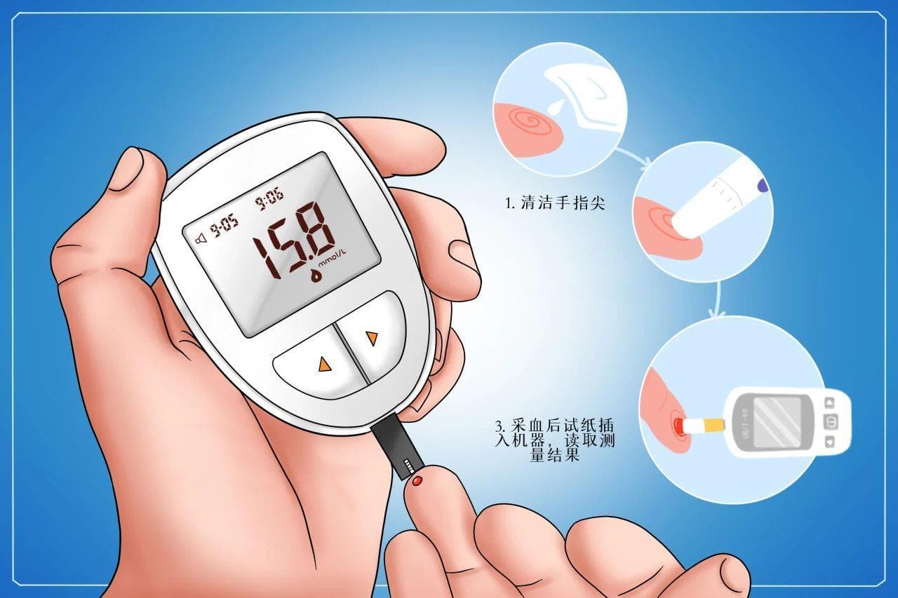 血糖怎样才能测得准？教你四种常见测量方式