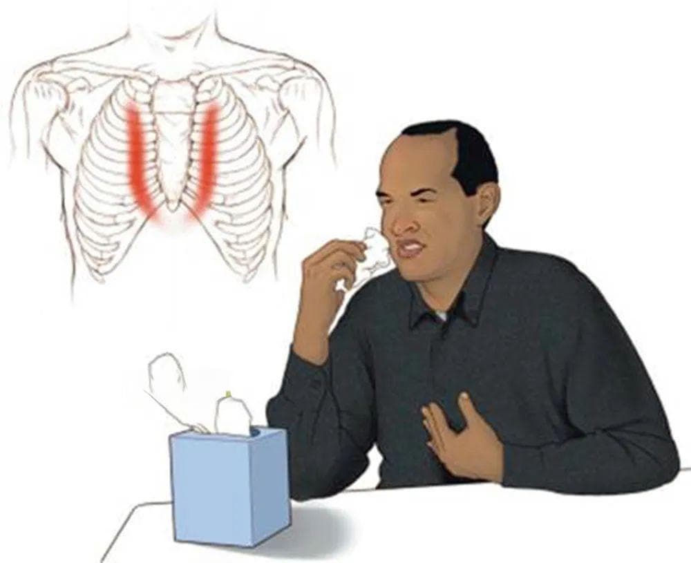 Tietze综合征：胸肋关节肿胀征