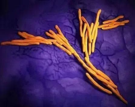 结核病防治科普知识宣传