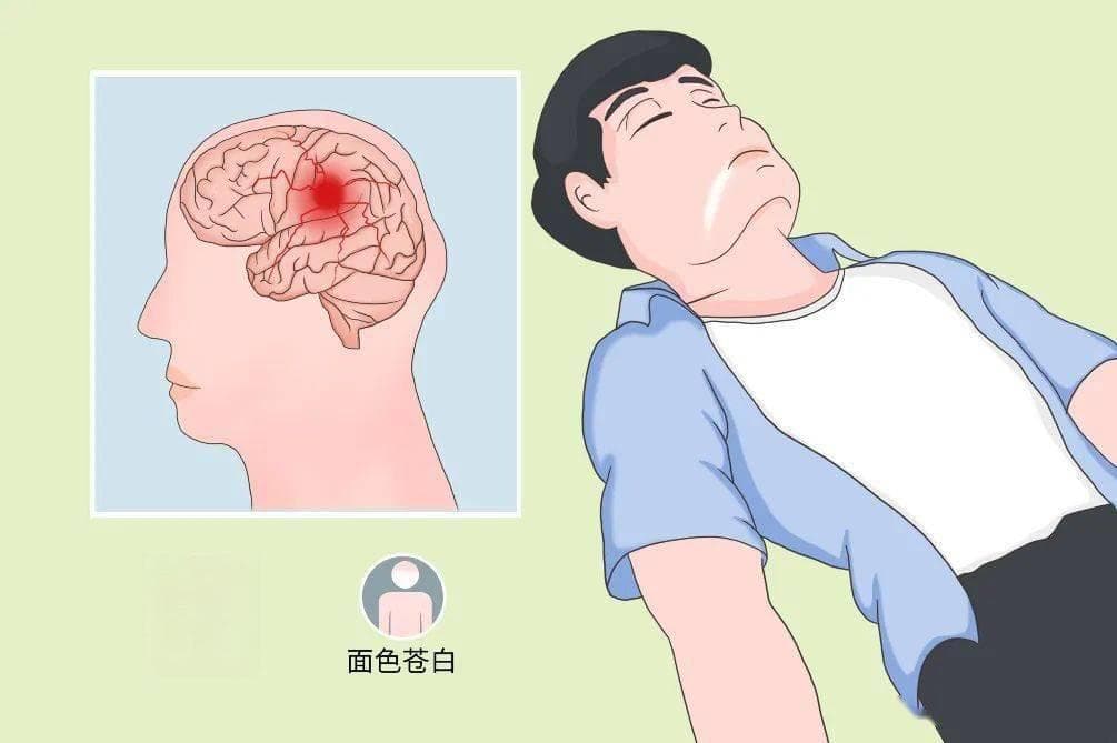 颅脑创伤：小小撞击，大大风险